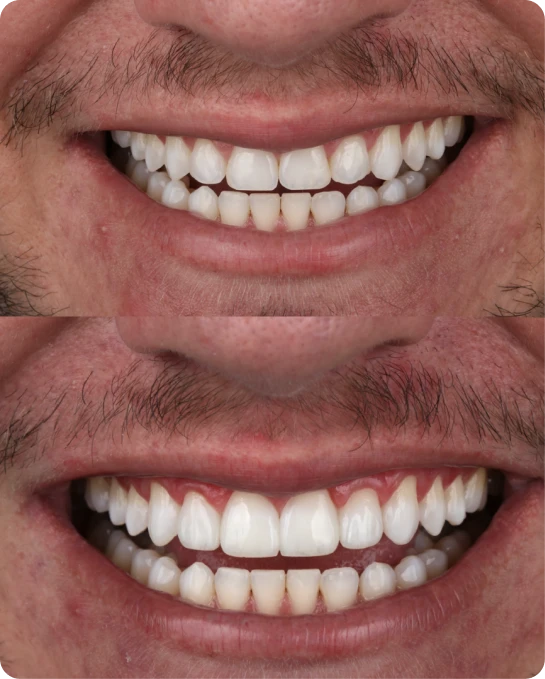 captura_de_tela_2023_02_10_a_s_21_25_54_3_1_1x