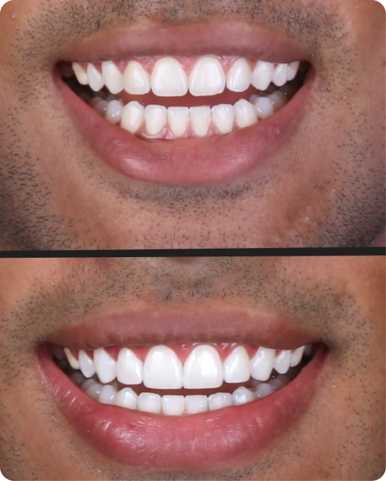 captura_de_tela_2023_02_10_a_s_21_25_54_3_3_1x