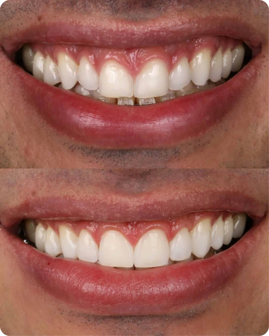 captura_de_tela_2023_02_10_a_s_21_25_54_3_4_1x