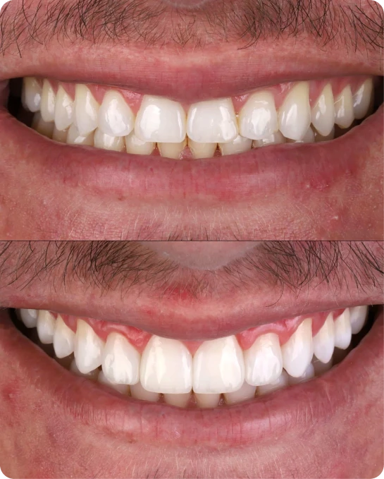 captura_de_tela_2023_02_10_a_s_21_25_54_3_5_1x