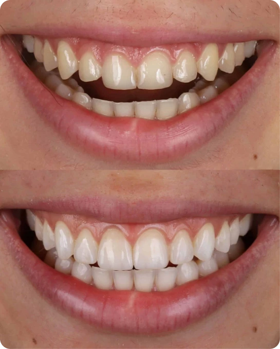 captura_de_tela_2023_02_10_a_s_21_25_54_3_6_1x