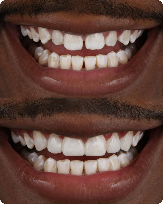 captura_de_tela_2023_02_10_a_s_21_25_54_3_7_1x