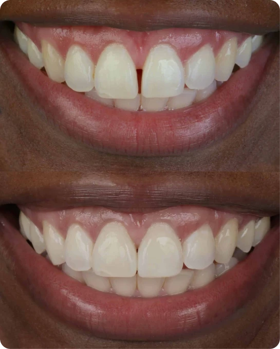 captura_de_tela_2023_02_10_a_s_21_25_54_3_8_1x